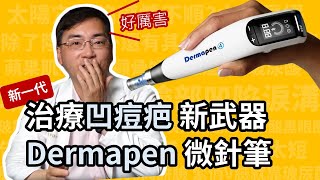 治凹痘疤，新武器 Dermapen 得美微針筆，第四代微針筆，治療凹痘疤快速又方便！ [upl. by Kienan]