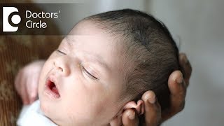 How to ensure right shape of head in newborns  Dr Varsha Saxena [upl. by Sivart]