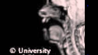 MRI uvular fricative [upl. by Maddis]