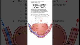 Diseases that affect DLCO [upl. by Hagan]