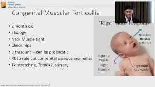 Torticollis [upl. by Grae213]