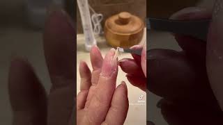 Finger peeling with palmoplantar keratoderma hand callus EPPK  Apr 6 2023 [upl. by Ikkiv]