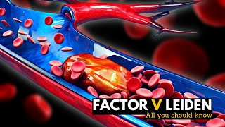 Factor V Leiden Everything You Need To Know [upl. by Enoid]