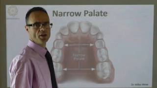 A Narrow Palate By Dr Mike Mew [upl. by Acinna84]