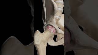 🦴 Hip Arthrosis When the Hip Joint Wears Down anatomy [upl. by Eznyl183]