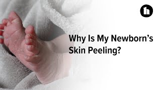 Why is My Newborns Skin Peeling  Healthline [upl. by Akayas]