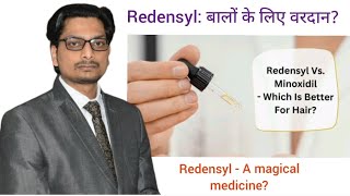 Redensyl vs Minoxidil in treatment of Androgenetic Alopecia Redensyl की उपयोगिता गंजापन के इलाज में [upl. by Prudhoe439]