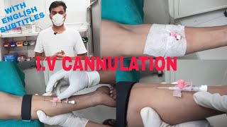 Intravenous Cannulation Technique  Iv Cannulation Procedure [upl. by Nivram]