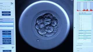 Embryoscope™  CREATE Fertility [upl. by Artemla]