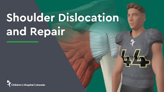 Shoulder Dislocation and Repair [upl. by Yedrahs140]