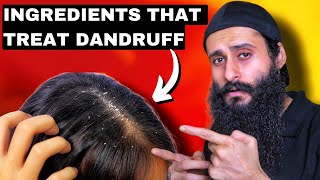 AntiDandruff Ingredients That You Should Know  Bearded Chokra [upl. by Libb]