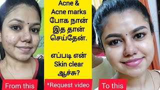 How I cleared my acne  My skincare routine for Acne amp Acne marks  Best products for pimple skin [upl. by Dressler384]