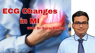 ECG Changes in Myocardial Infarction with DrSuraj [upl. by Suzy]