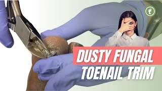 DUSTY FUNGUS ✂️ TOENAIL TRIM [upl. by Murdock]