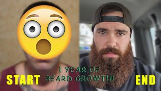 1 YEAR BEARD GROWTH TIMELAPSE [upl. by Cykana789]