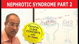 Nephrotic Syndrome  Part 2🩺 [upl. by Guttery]