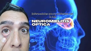 Enfermedad que se confunde con la Esclerosis Múltiple Neuromielitis Óptica [upl. by Chirlin684]