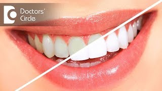 Teeth cleaning vs teeth whitening  Dr Sumanth M Shetty [upl. by Erickson]