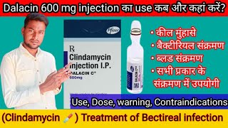 Clindamycin injectionuse कब और कहां करें पूरी जानकारीDalacin c 600mg injectionuseDosewarningquot [upl. by Rawdin536]