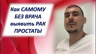 РАК простаты Как самому без уролога выявить рак простатыПростатический специфический антигенПСА [upl. by Lorne]