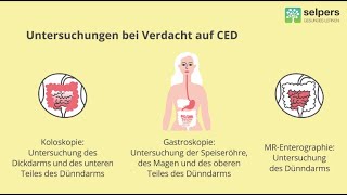 Magen und Darmspiegelung bei CED  was kommt auf mich zu Arzt erklärt Untersuchungen [upl. by Cecelia]