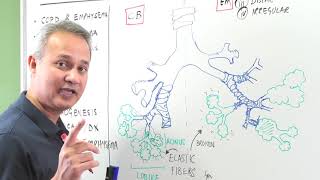 Comparison of Emphysema with Chronic Bronchitis [upl. by Yanehs]