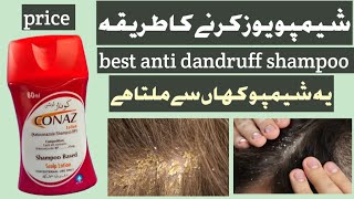 Conaz anti dandruff shampoo reviewhow to use conaz anti dandruff shampoo [upl. by Harty]