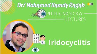 Uvea 2 Iridocyclitis [upl. by Aelber]