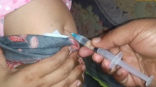 IM Intramuscular Arm injection PushPheniramine Meleate Avil 24 Ep 121 Anik Health Tips [upl. by Wendolyn]