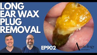 LONG EAR WAX PLUG REMOVAL  EP902 [upl. by Bik]