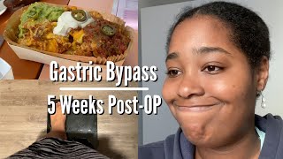 Gastric Bypass  5 Weeks PostOp  Dumping Syndrome  Current Weight [upl. by Garner]