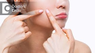 What causes hormonal acne  Dr Priya J Talageri [upl. by Dorlisa486]