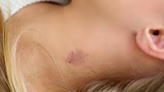 how to make a fake hickey on your neck with makeup fast [upl. by Aymik560]