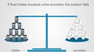 Hyponatremia Basics Understanding Water Intake amp Urine Output [upl. by Stephi63]