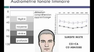 exploration de la fonction auditive [upl. by Voccola]