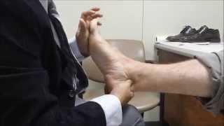 Examination of Flexor Hallucis Longus Tenosynovitis posterior Ankle Impingement examination [upl. by Whipple]