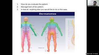 TIPSECHO Season 169 FCPM 36 Session 18Palliative Care Emergencies Dr Ravi Kiran Pothamsetty [upl. by Zelma]