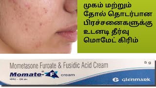 momate f cream review tamil Best cream for clear skinmosquito bite and skin allergy [upl. by Harmonie]