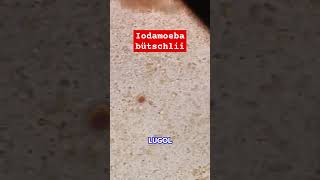 Iodamoeba bütschlii microscope microbiologia microscopio science biology [upl. by Yedok]