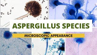 Aspergillus species microscopic appearance  Aspergillus identification Clear explanation [upl. by Mihsah593]