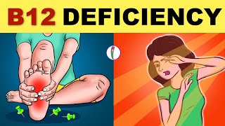 Vitamin B12 Deficiency Symptoms  B12 Deficiency  Vitamin B12  All You Need to Know [upl. by Corny]