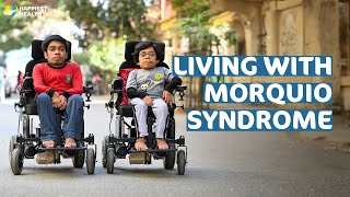 My Story  Living with Morquio syndrome [upl. by Naibaf408]