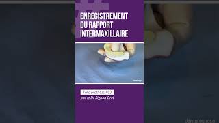 🦷 Tuto Prothèse 03  Lenregistrement du rapport intermaxillaire [upl. by Anurag513]