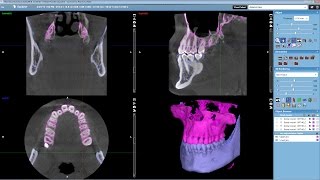 Planmeca Romexis® 45 highlights [upl. by Aivatan]