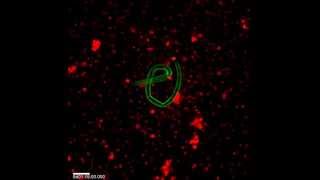 Eosinophils Detect a Worm and Swarm [upl. by Bayless]