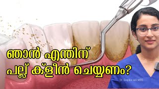 Tooth Cleaning  Teeth Scaling I Stain or Tartar Removal cost  Oral Hygiene Dentalexperiencein [upl. by Adihsaar521]