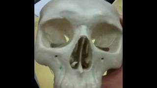 Vomer inferior nasal conchae ethmoid zygomatic bones tes [upl. by Devan]