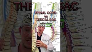 𝗠𝗼𝘀𝘁 𝗱𝗼𝗻’𝘁 𝗸𝗻𝗼𝘄 Spinal Cord vs Thecal Sac [upl. by Reseda404]