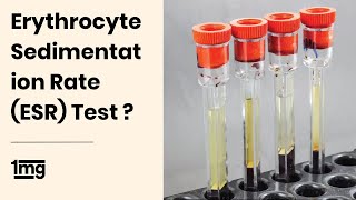 What is Erythrocyte Sedimentation Rate ESR Test  1mg [upl. by Yrollam]