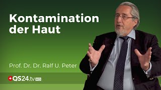 Hautschäden nach Strahlenunfällen  Prof Dr Dr Ralf U Peter  Naturmedizin  QS24 [upl. by Goldy492]